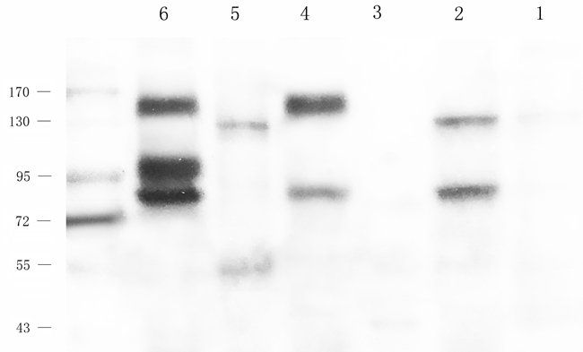 ARL13B Rabbit Polyclonal Antibody