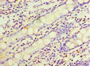 ARL4D Antibody