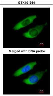 ARPC2 Rabbit Polyclonal Antibody