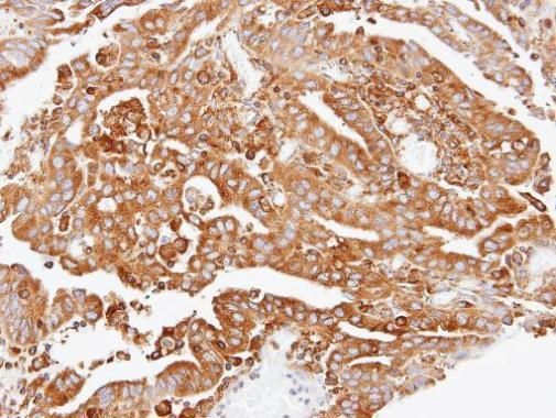 ARPC2 Rabbit Polyclonal Antibody