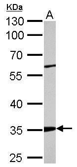 ARPC2 Rabbit Polyclonal Antibody