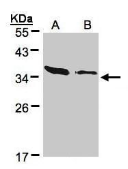 ARPC2 Rabbit Polyclonal Antibody
