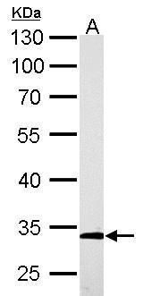 ARPC2 Rabbit Polyclonal Antibody
