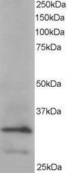 ARPC2 Antibody