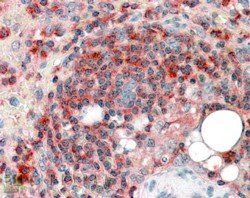 ARPC2 Antibody