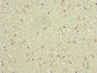 ARPC5 Antibody