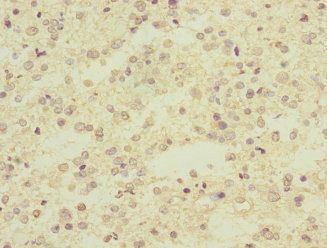 ARPC5 Antibody
