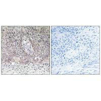 ARSA Antibody