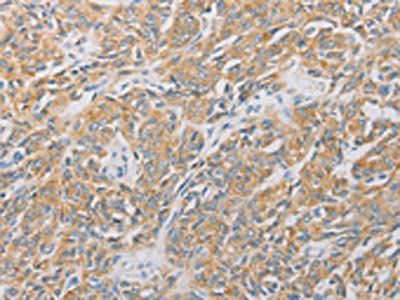 ARSG Antibody