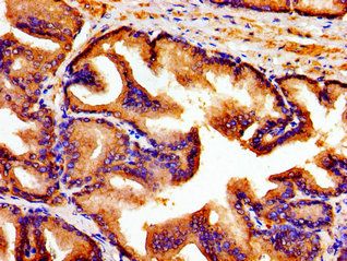 ARTN Antibody