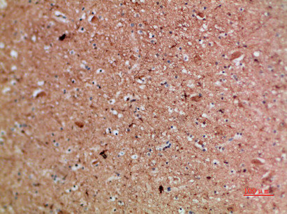 ARTN Antibody