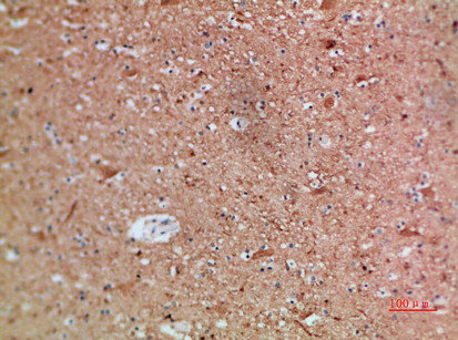 ARTN Antibody