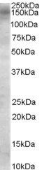 AS160/TBC1D4 Antibody