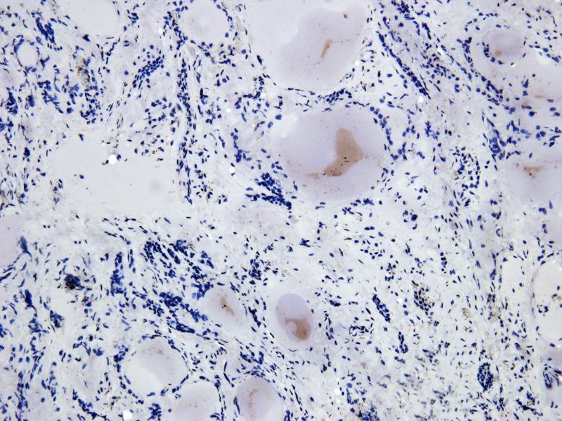 ASGR1 Rabbit Polyclonal Antibody