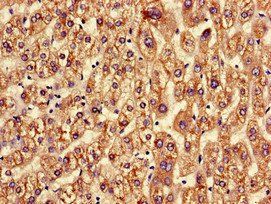 ASGR2 Antibody