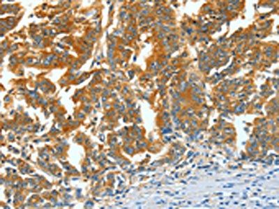 ASNS Antibody