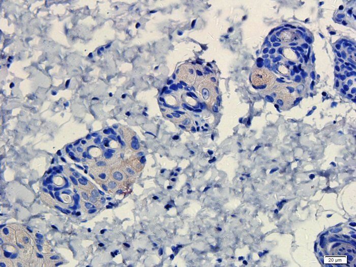 ATAD2 Rabbit Polyclonal Antibody