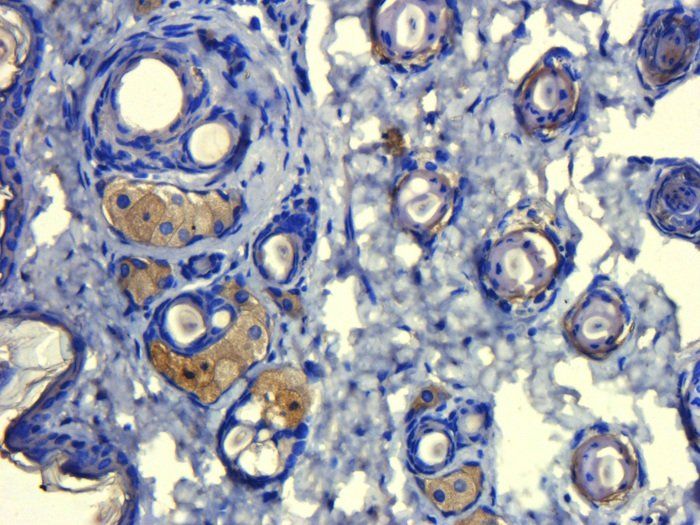 ATAD2 Rabbit Polyclonal Antibody