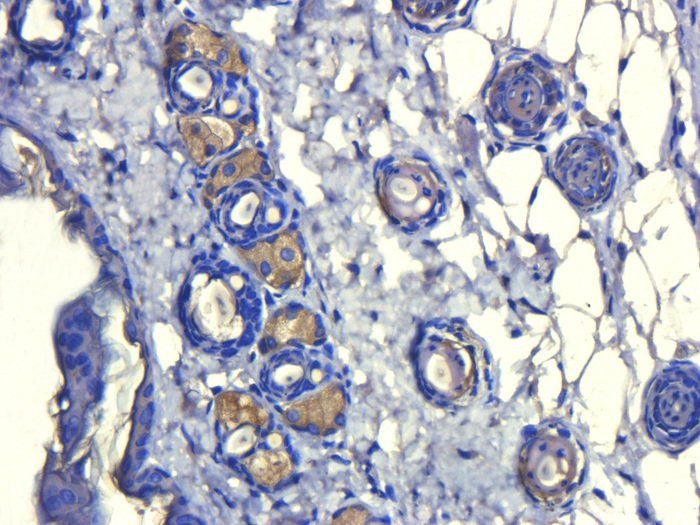 ATAD2 Rabbit Polyclonal Antibody