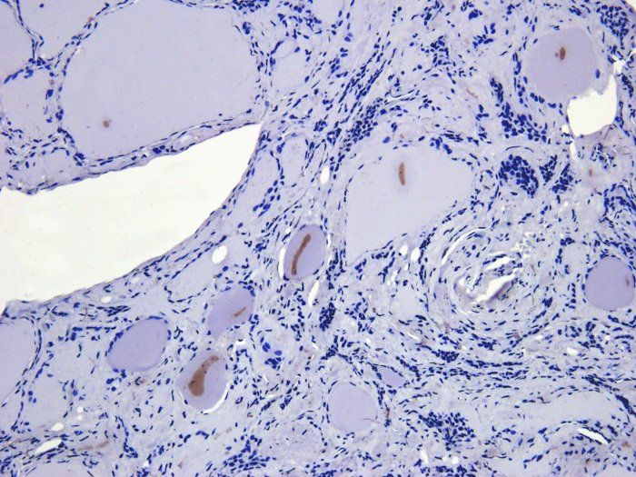 ATAD2 Rabbit Polyclonal Antibody
