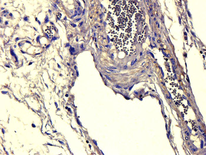 ATAD2 Rabbit Polyclonal Antibody