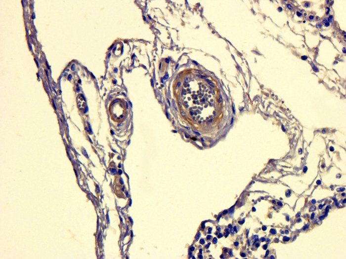 ATAD2 Rabbit Polyclonal Antibody