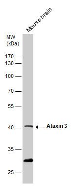 Ataxin 3 Rabbit Polyclonal Antibody