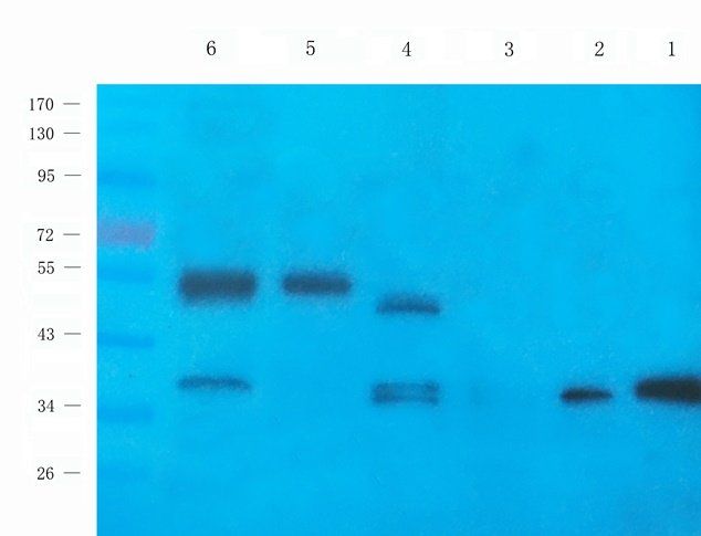 ATF4 Rabbit Polyclonal Antibody
