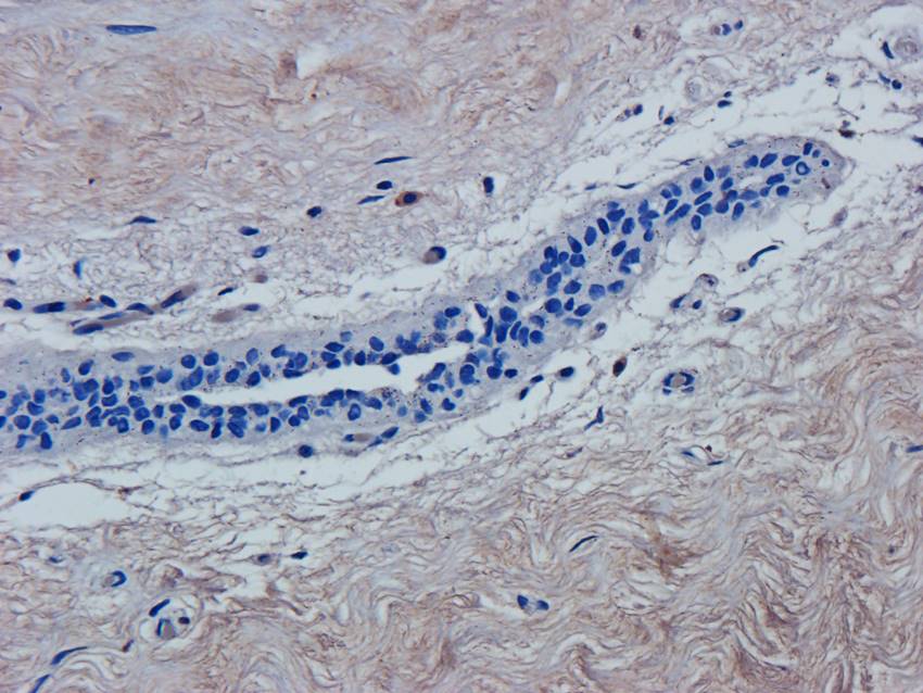 ATF6 Rabbit Polyclonal Antibody