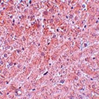 ATG101 Rabbit Polyclonal Antibody
