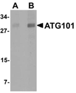 ATG101 Rabbit Polyclonal Antibody