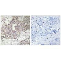 ATG4C Antibody