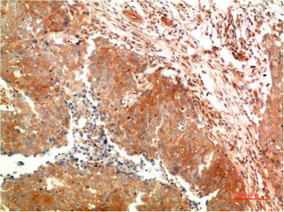 ATG5 Antibody