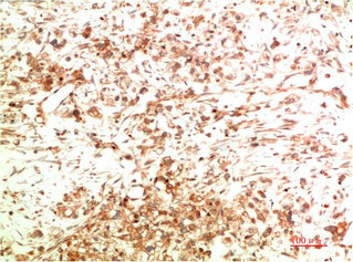 ATG5 Antibody