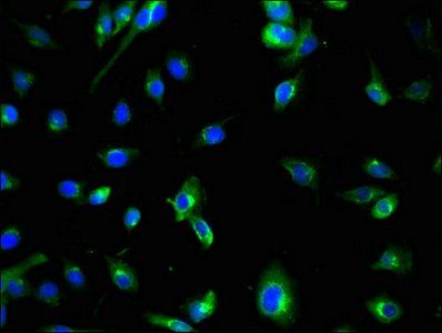 ATG7 Antibody