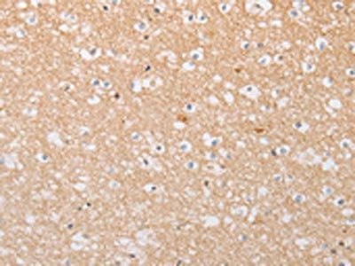 ATG9A Antibody