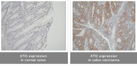 Mouse anti Human ATIC Antibody