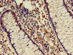 ATIC Antibody