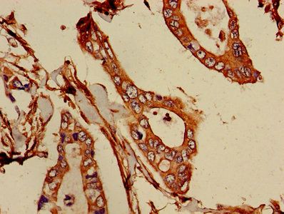 ATIC Antibody