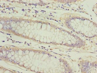 ATL2 Antibody