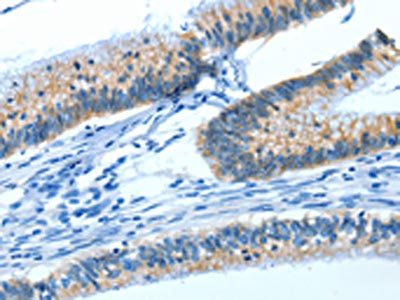 ATP1A1 Antibody