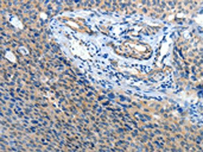 ATP1A1 Antibody