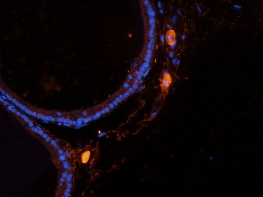 ATP1A2 Rabbit Polyclonal Antibody