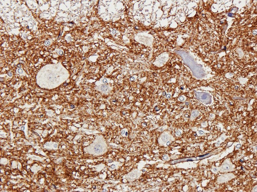 ATP1A2 Rabbit Polyclonal Antibody