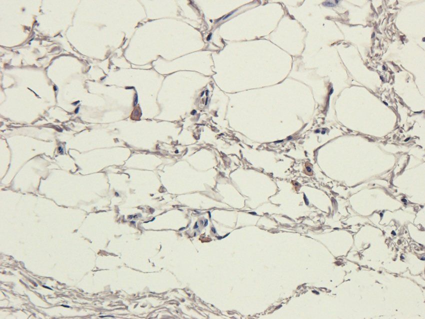 ATP1A2 Rabbit Polyclonal Antibody