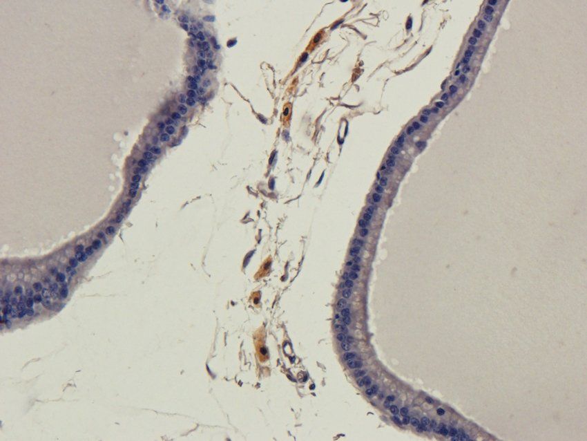ATP1A2 Rabbit Polyclonal Antibody