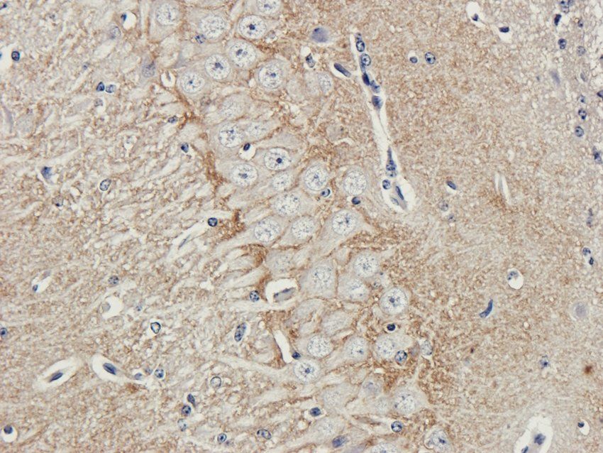 ATP1A2 Rabbit Polyclonal Antibody