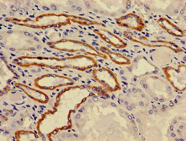 ATP6V0A1 Antibody
