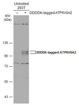 ATP6V0A2 Rabbit Polyclonal Antibody