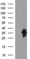 ATP6V1B2 Antibody